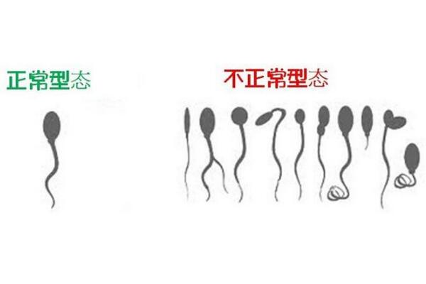 精子畸形率高怎么办